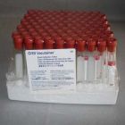 Blood Tubes - 10 mL Red Top 100 Count